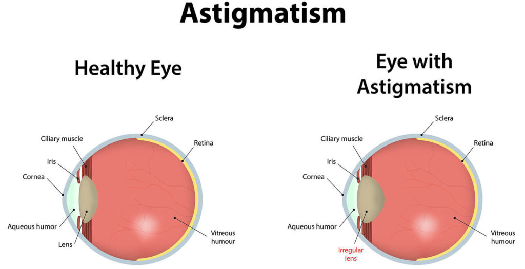 The Complete Guide to Binoculars for Eyeglass Wearers | BINOCULARS GUIDES